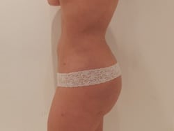 After Image