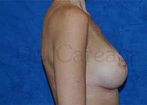 After Image