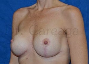 After Image