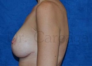 After Image