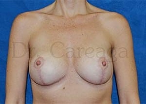 After Image
