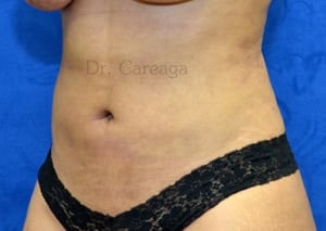 After Image
