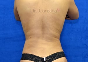 After Image