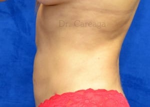After Image