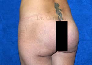 After Image