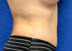 After Image