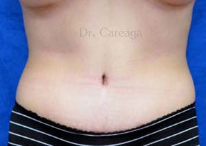 After Image
