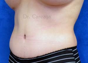 After Image