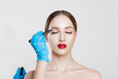Blepharoplasty (Eyelid/EyeLift) Plastic Surgery