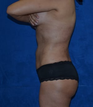 After Image