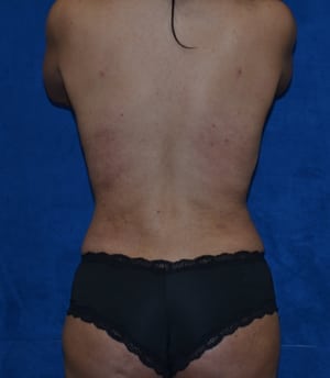 After Image