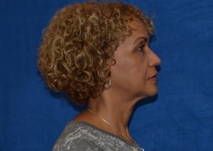 After Image