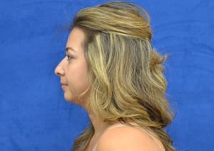 After Image