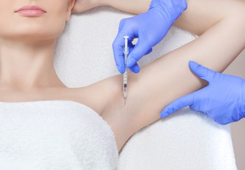 The doctor makes intramuscular injections of botulinum toxin in the underarm area against hyperhidrosis.-img-blog