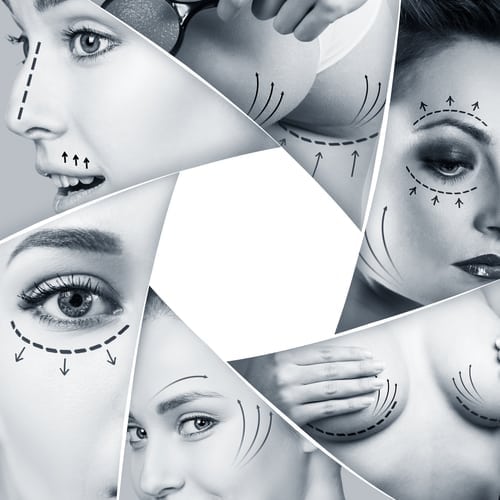 Collage of plastic surgery