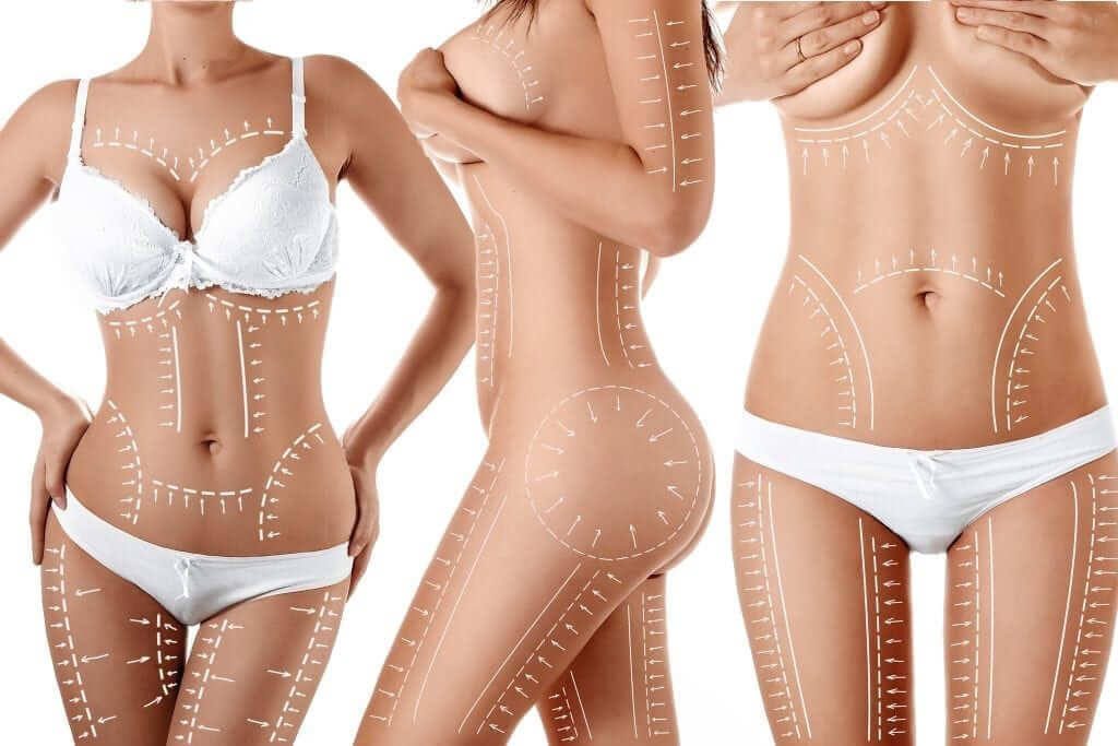 Top Five Surgical Procedures of 2017