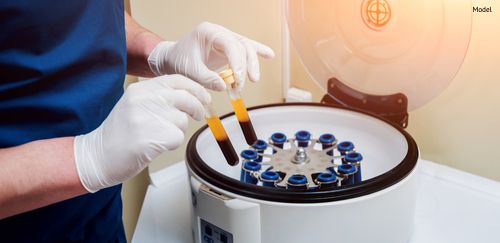 Platelet-Rich plasma preparation