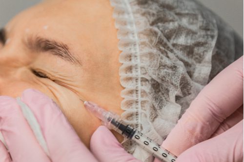 BOTOX® Cosmetic is injected into the muscles to reduce the appearance of crow's feet.