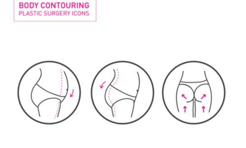 The Brazilian Butt Lift augments and lifts the buttocks by injecting fat removed with liposuction.