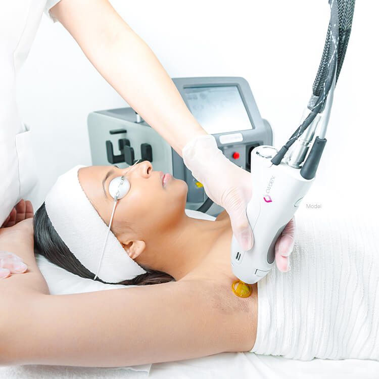 laser hair removal feautred image