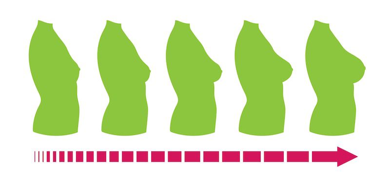 Vector illustration of different breast sizes for breast augmentation purposes.