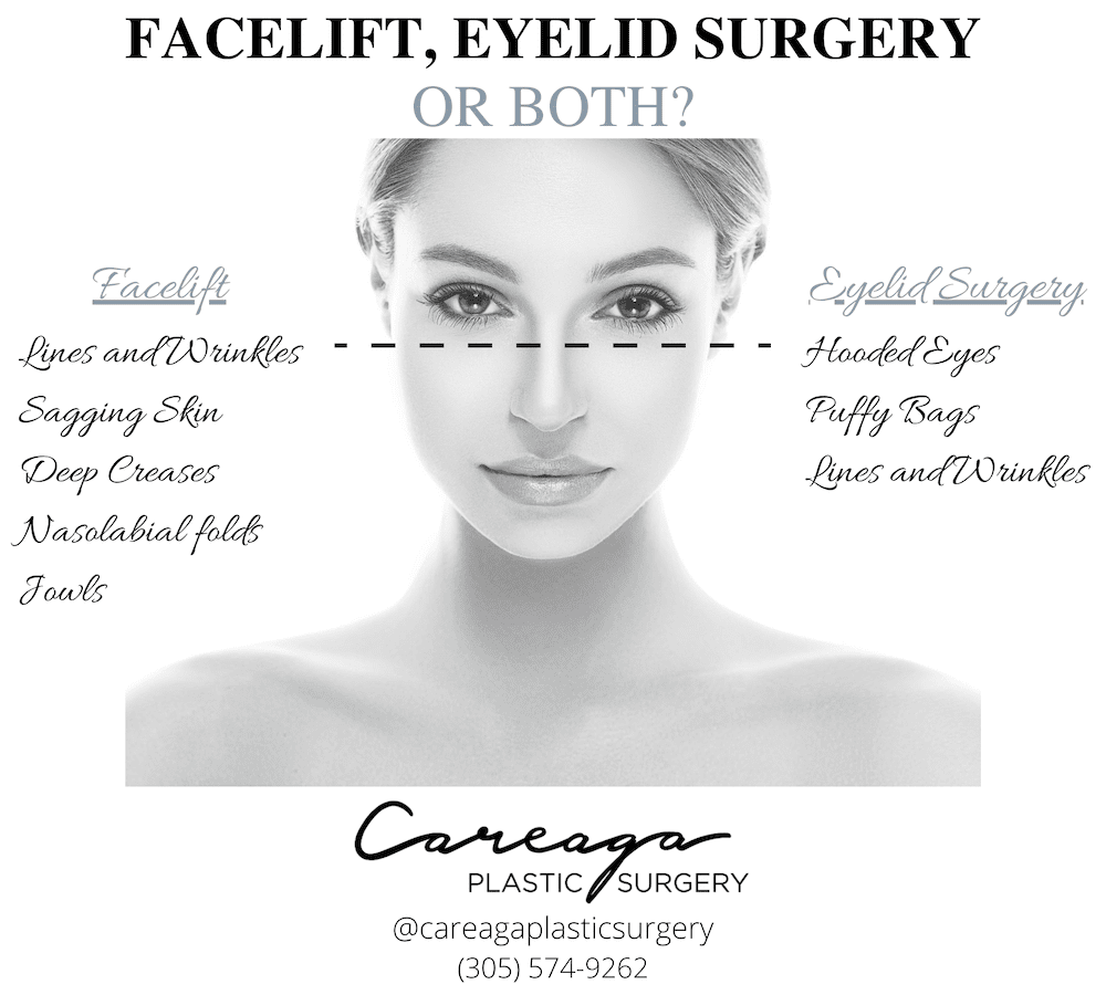 Infographic showing what can be accomplished with eyelid surgery and what can be with facelift surgery.