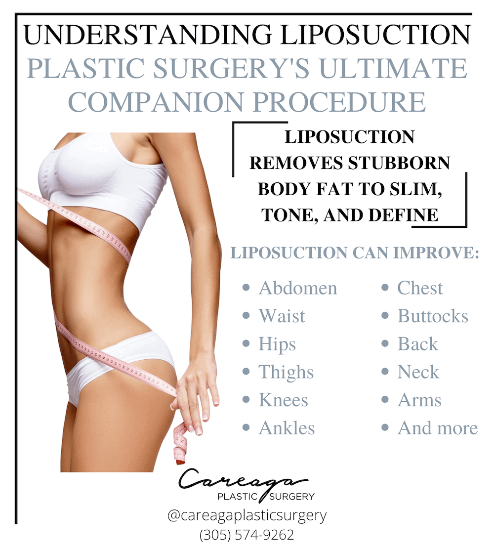 Infographic showing the body areas that liposuction can treat. 