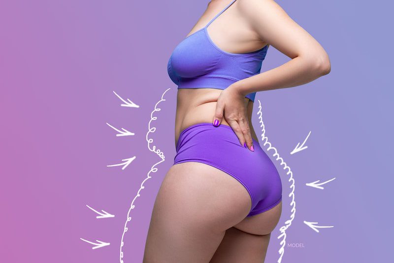 Woman's fit body outlined by bigger shape to indicate plastic surgery.