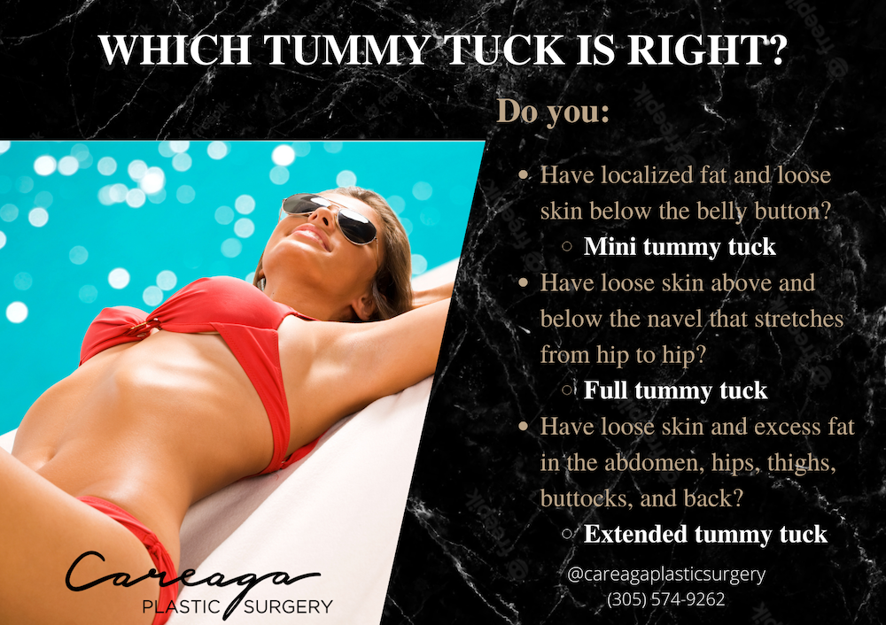 Infographic showing the different types of tummy tuck.