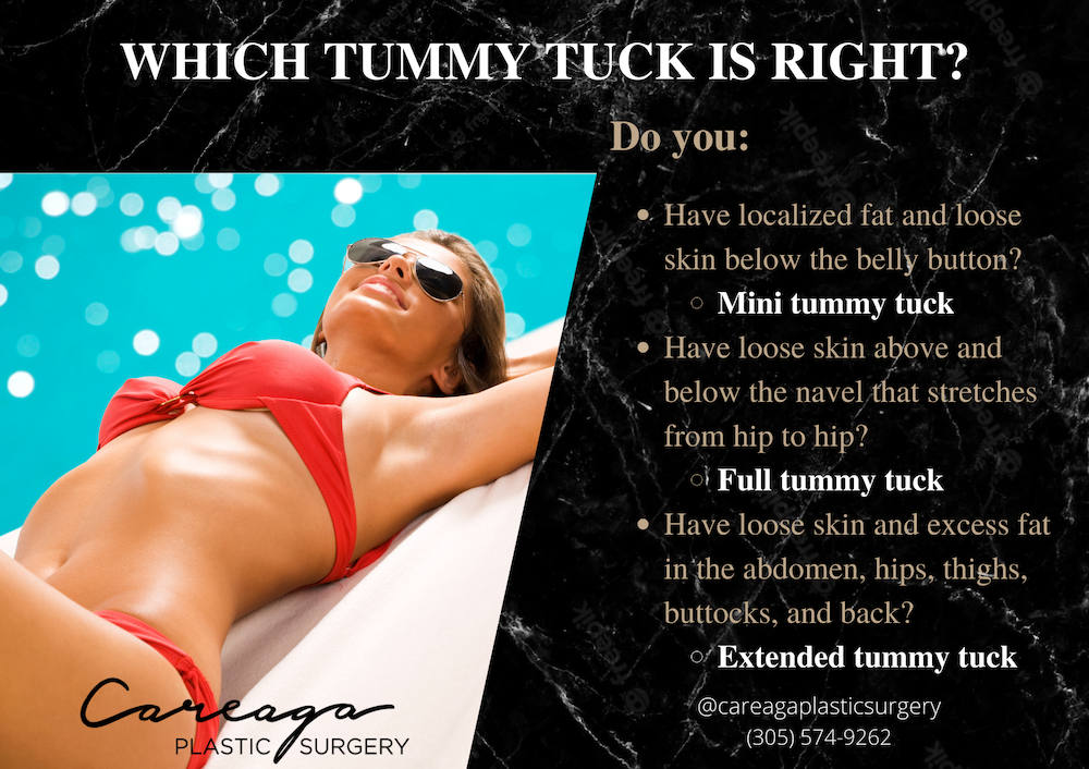 Infographic showing the different types of tummy tuck. 