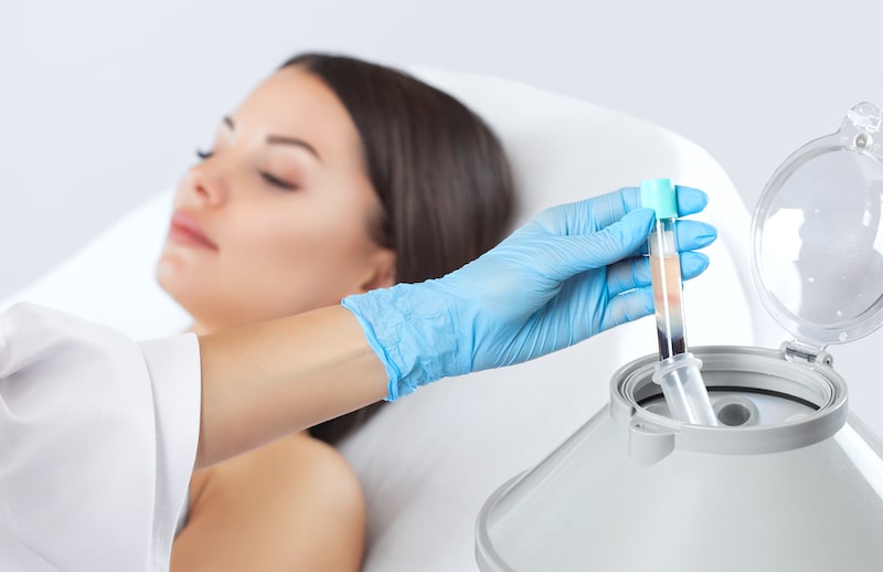 PRP – Is the Sky the Limit? These 7 Cosmetic Benefits Say Yes