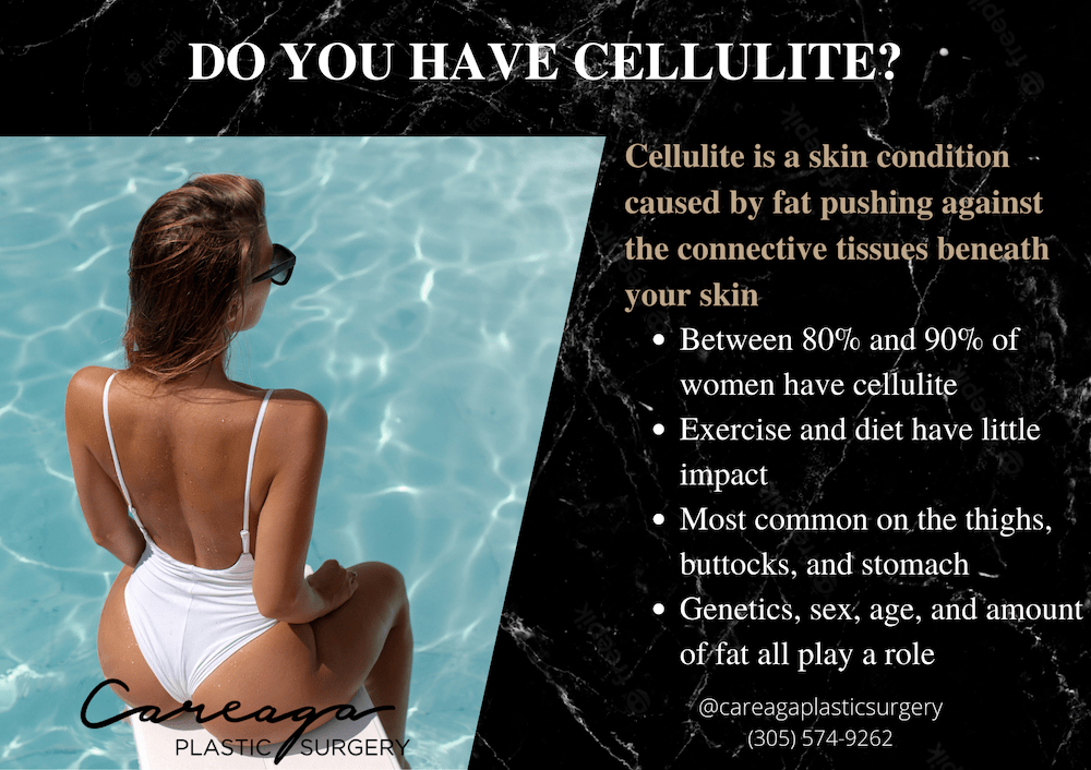 Infographic showing statistics on cellulite