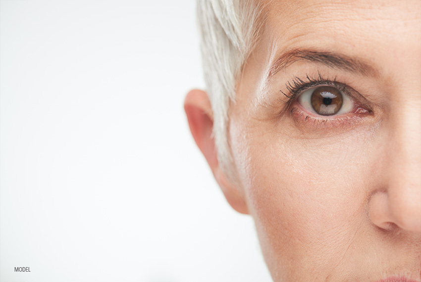 Woman with signs of aging around her eyes