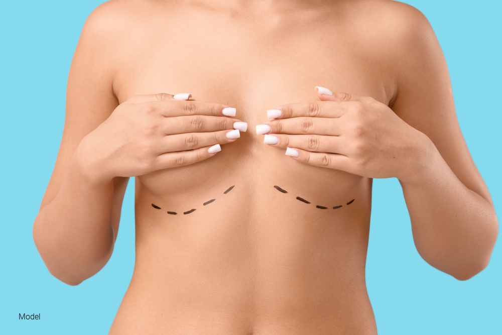 Preservé Breast Augmentation