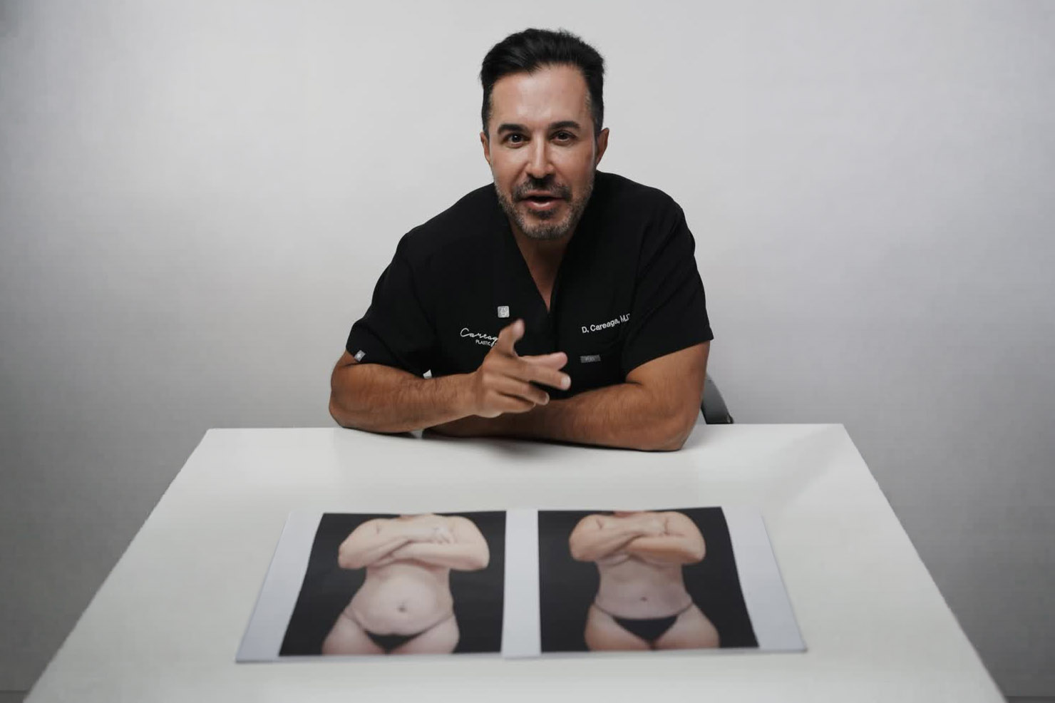 Dr. Careaga talks about Tummy Tuck