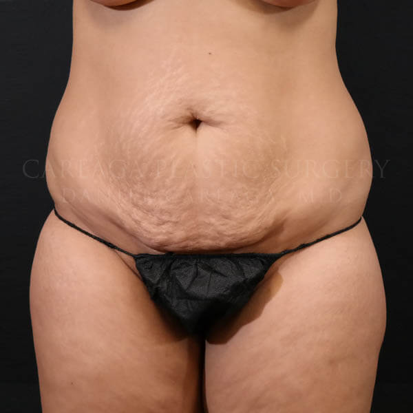 Before Image