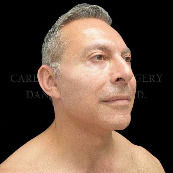 After Image
