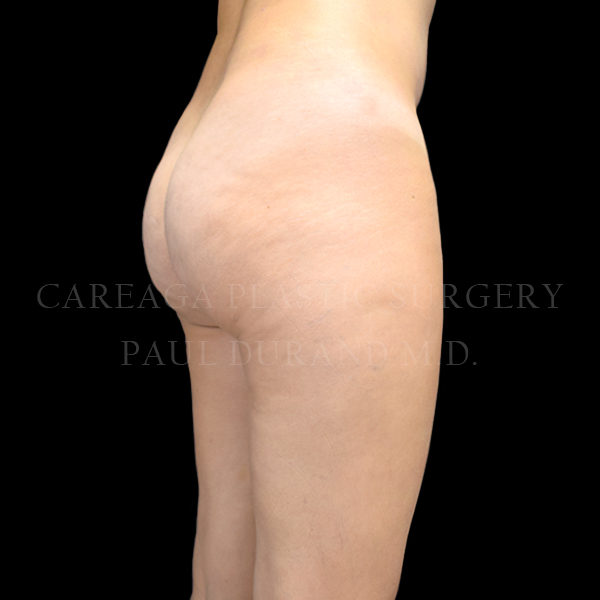 After Image
