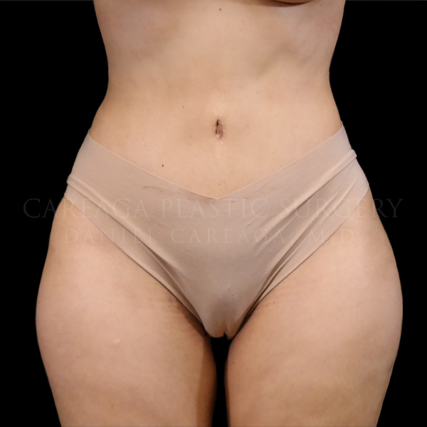 After Image
