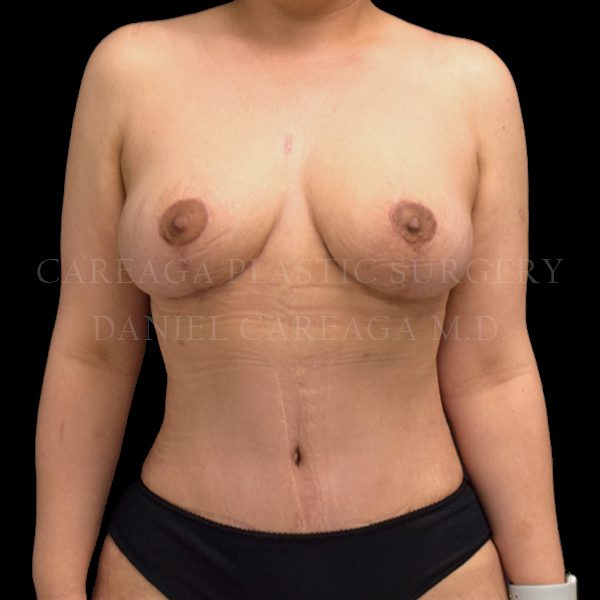 After Image
