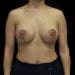 After Image