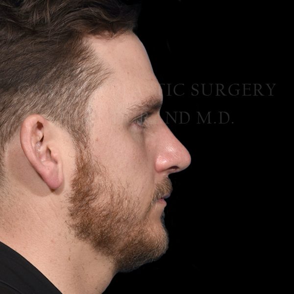 After Image