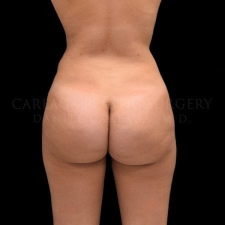 After Image