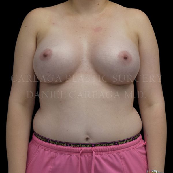 After Image