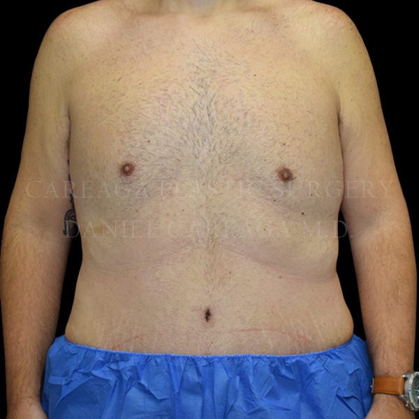 After Image