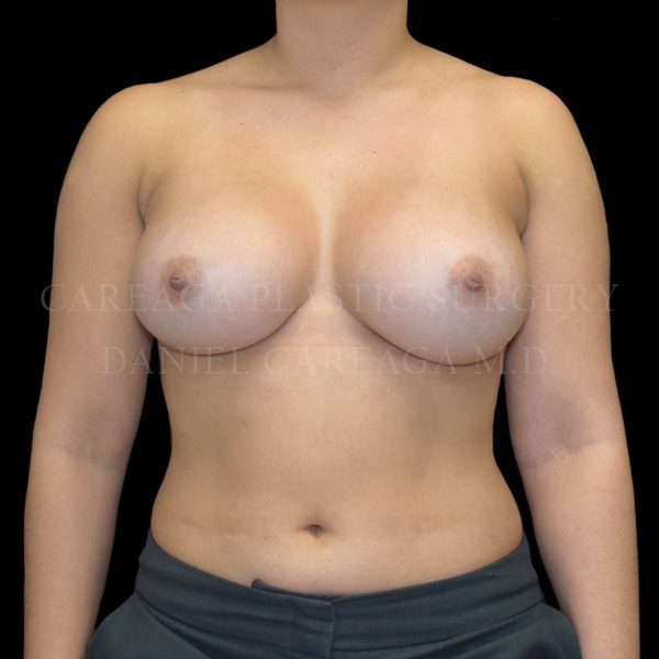 After Image