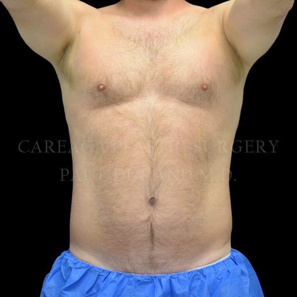 After Image