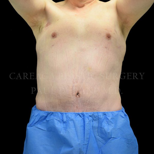 After Image