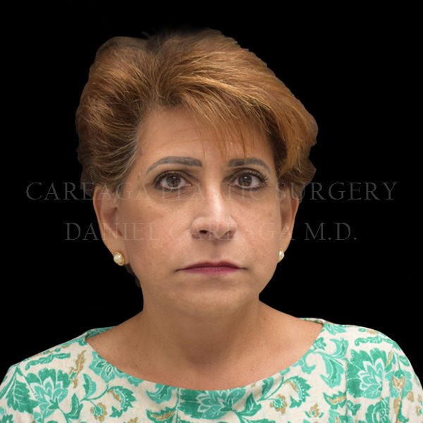 After Image