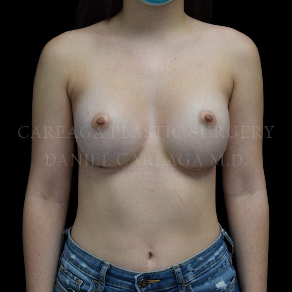 After Image